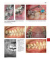 Tratamiento Ortodóncico y Ortopédico Dentofacial - Thomas Rakosi