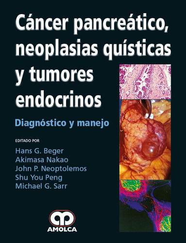 CANCER PANCREATICO, NEOPLASIAS QUISTICAS Y TUMORES ENDOCRINOS - Hans Beger