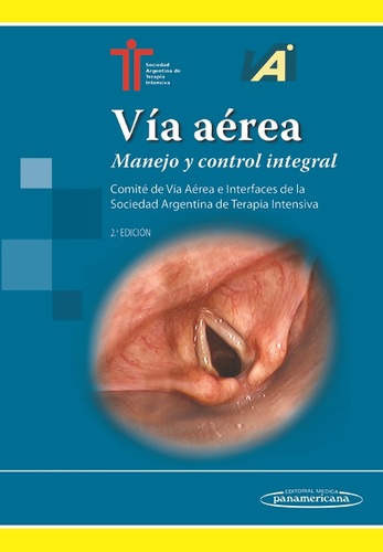 VIA AEREA MANEJO Y CONTROL INTEGRAL - Sociedad Argentina de Terapia Intensiva