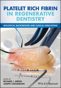 PLATELET RICH FIBRIN IN REGENERATIVE DENTISTRY: BIOLOGICAL BACKGROUND AND CLINICAL INDICATIONS - Joseph Choukroun 