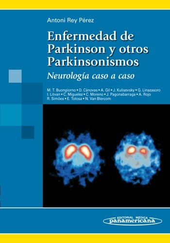 ENFERMEDAD DE PARKINSON Y OTROS PARKINSONISMOS - Rey