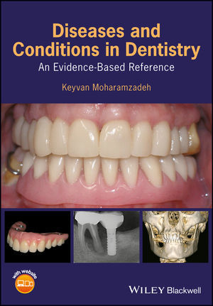 DISEASES AND CONDITIONS IN DENTISTRY. AN EVIDENCE-BASED REFERENCE - Moharamzadeh