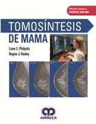 TOMOSINTESIS DE MAMA - Philpotts