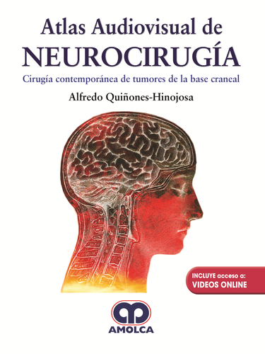 ATLAS AUDIOVISUAL DE NEUROCIRUGIA - Quiñones-Hinojosa