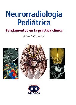Neurorradiología Pediátrica. Fundamentos en la Práctica Clínica - Choudhri
