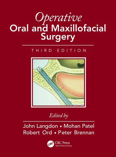 OPERATIVE ORAL AND MAXILLOFACIAL SURGERY -  Langdon / Patel / Ord / Brennan