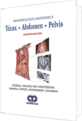 IMAGENOLOGÍA ANATÓMICA TÓRAX, ABDOMEN, PELVIS. Segunda edición - Federle