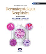 Diagnóstico Patológico. Dermatopatología Neoplásica (Incluye E-Book) - Cassarino / Dadras