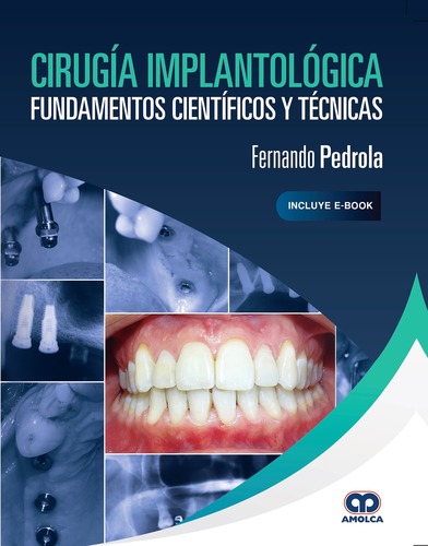 Cirugía Implantológica Fundamentos Científicos y Técnicas - Fernando Pedrola