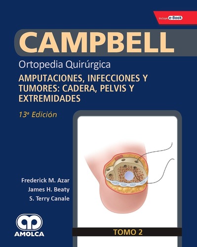 CAMPBELL Ortopedia Quirúrgica Tomo 2 13ed  Amputaciones, Infecciones y Tumores - Azar / Beaty / Canale