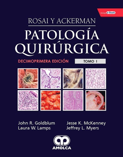 Rosai y Ackerman Patología Quirúrgica 11ed (2 Vols. + E-Book) - Goldblum 