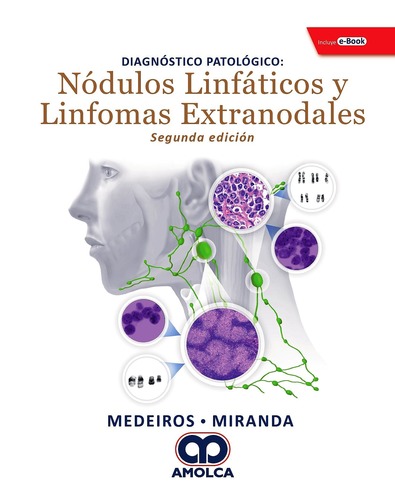 Diagnóstico Patológico Nódulos Linfáticos y Linfomas Extranodales + E-Book 2ed -Madeiros / Miranda
