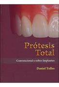Prótesis Total Convencional y sobre Implantes - Daniel Telles