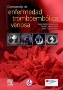 Compendio de Enfermedad Tromboembólica Venosa, Sonia Otálora