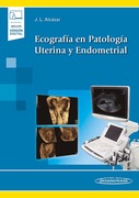 Ecografía en Patología Uterina y Endometrial (Incluye Versión Digital).-Alcázar, J.