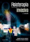 Fisioterapia invasiva - Valera