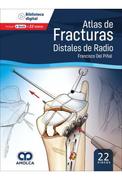 ATLAS DE FRACTURAS DISTALES DE RADIO‚ Con 22 Vídeos (Libro + eBook)