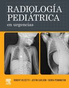  Radiología pediátrica en urgencias. -Vezzetti / Carlson / Pennington