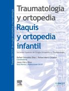 Traumatología y ortopedia. Raquis y ortopedia infantil. González Díaz