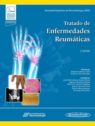 Tratado de Enfermedades Reumáticas. SER Sociedad Española de Reumatología. Balsa. 2ed