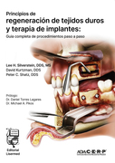 Principios de regeneración de tejidos duros y terapia de implantes: Guía completa de procedimientos paso a paso - Silverstein