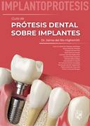 IMPLANTOPRÓTESIS Guía de Prótesis Dental sobre Implantes - Jaime del Río 