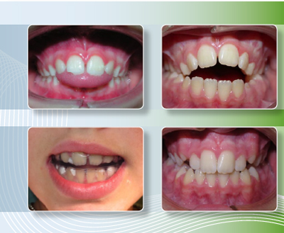 Desarrollo Postgrado Dentición Mixta Dra. Charo Cuesta