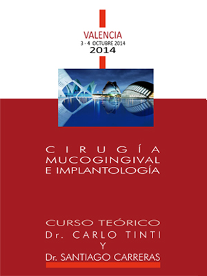 Curso Cirugía Mucogingival e Implantología Dr. Carlo Tinti & Dr. Santiago Carreres