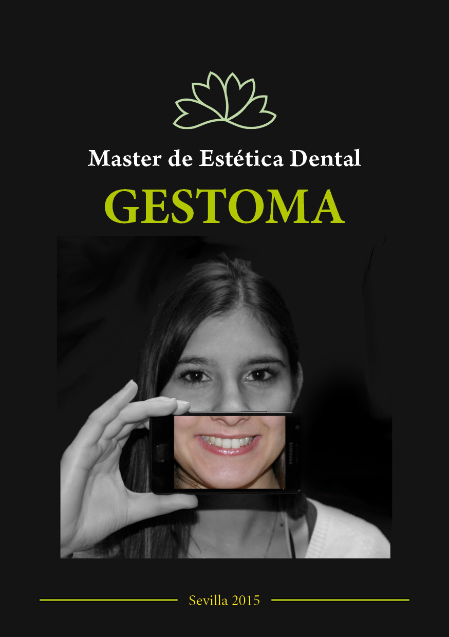 Curso de Estética Dental -Dr. Jiménez Portillo  Dr. Oscar Pecho  Dr. Bruno Pereira - Gestoma