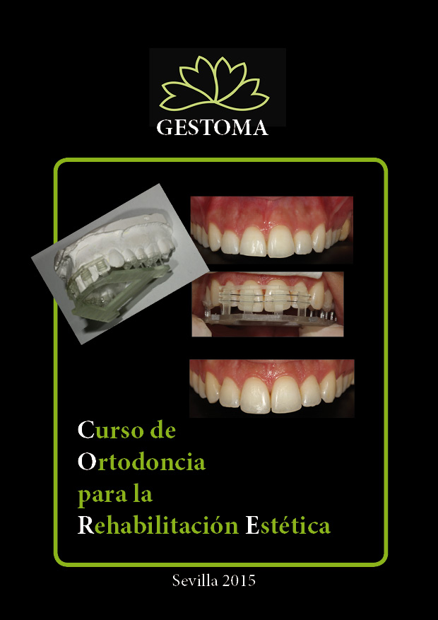 Curso de Ortodoncia para la Estética dental - Gestoma