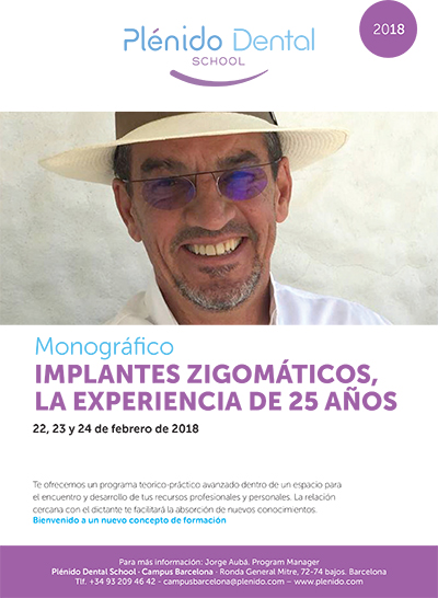 Implantes Zigomáticos la experiencia de 25 años Carlos Aparicio