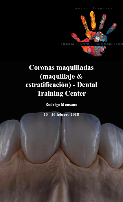 Coronas maquilladas (maquillaje & estratificación) - Dental Training Center - Rodrigo Monsano