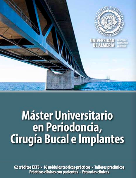 Máster Universitario en Periodoncia, Cirugía Bucal e Implantes Universidad de Almería
