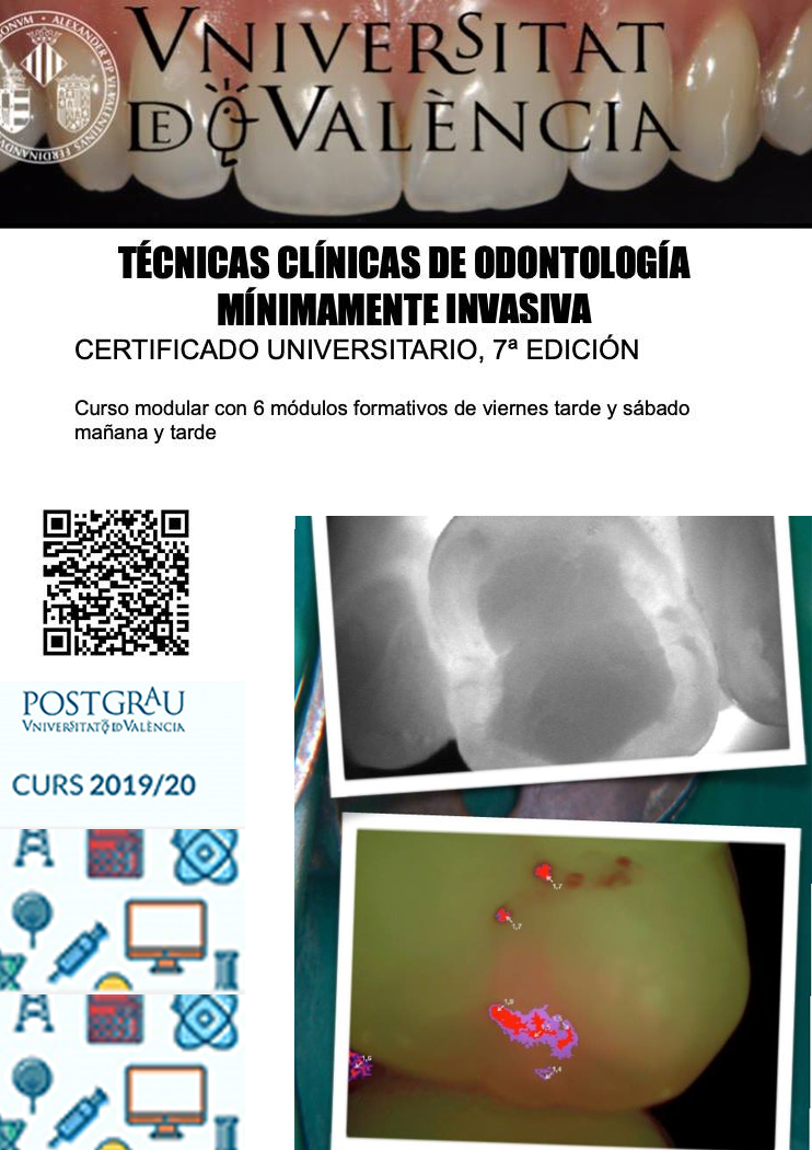 Certificado Universitario en Técnicas Clínicas de Odontología Mínimamente Invasiva- Dr. Agustín Pascual
