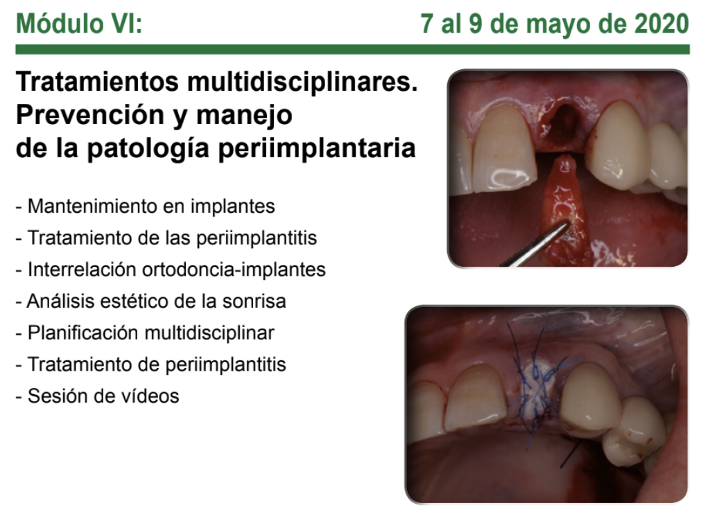 implantologia estética multidisciplinar 6ª edicion