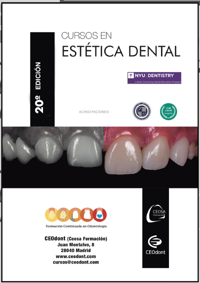 http://www.libreriaserviciomedico.com/2020/1/23/150729/titulo-de-experto-en-estetica-dental-19-ceodont-2019