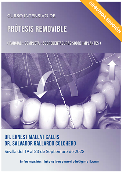 Curso Intensivo de Prótesis REMOVIBLE (parcial, completa y sobredentaduras sobre implantes) - Ernest Mallat & Salvador Gallardo
