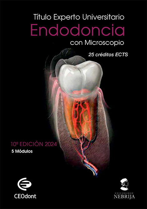 Experto Universitario en Endodoncia Dr Liñares_Ceodont